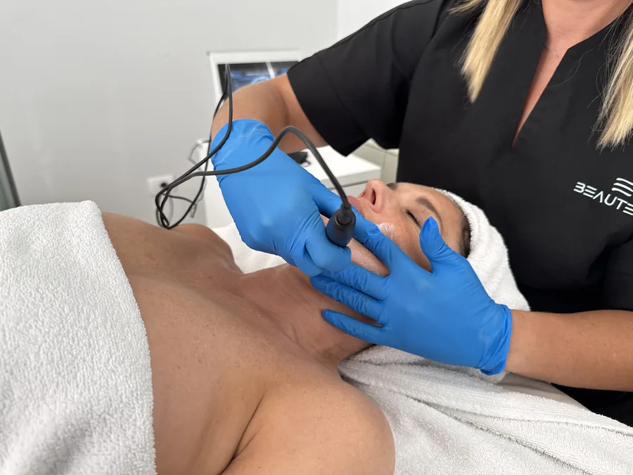 Trattamento di aesthetic pricking in cabina