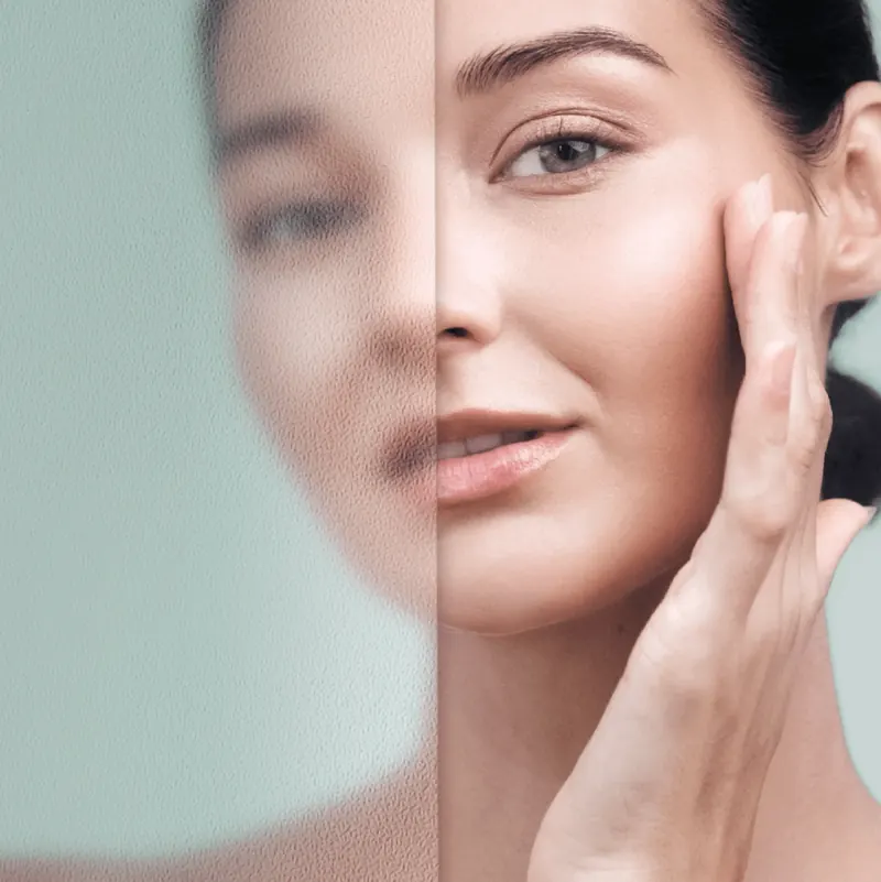 Sublime Peel